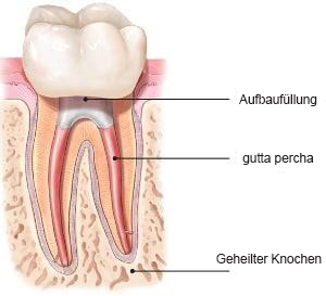 Endodontie, Mikroskop