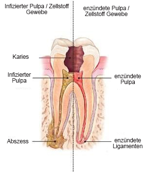Endodontie, Mikroskop