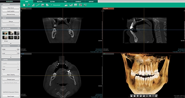 3D_ct