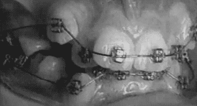 orthodontics_hu_01
