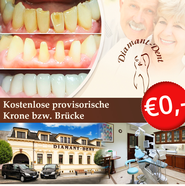 Kostenlose provisorische Krone bzw. Brücke